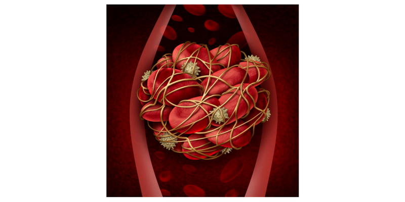 cabecera-post-trombosis